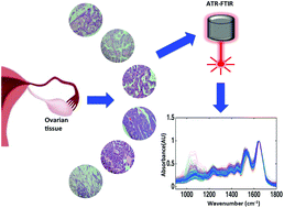 Graphical abstract: ATR-FTIR spectroscopy coupled with chemometric analysis discriminates normal, borderline and malignant ovarian tissue: classifying subtypes of human cancer