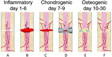 Graphical abstract: Hydrogels that allow and facilitate bone repair, remodeling, and regeneration