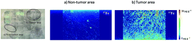 Graphical abstract: Quantitative bioimaging of Ca, Fe, Cu and Zn in breast cancer tissues by LA-ICP-MS