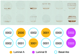 Graphical abstract: Biomarker barcodes: multiplexed microfluidic immunohistochemistry enables high-throughput analysis of tissue microarray