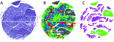 Graphical abstract: Statistical analysis of a lung cancer spectral histopathology (SHP) data set