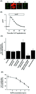 Graphical abstract: Water-soluble jack-knife prawn extract inhibits 5-hydroxytryptamine-induced vasoconstriction and platelet aggregation in humans