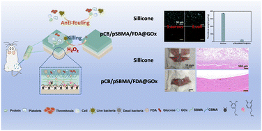 Graphical abstract: Anti-swelling, antithrombotic and antibacterial zwitterionic hydrogel coatings with a sandwich structure on polymer substrates