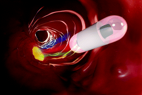 Graphical abstract: New optical method for enhanced detection of colon cancer by capsule endoscopy