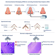 Graphical abstract: Strip electrodes: a novel, effective and minimally invasive therapeutic option for correcting DNS via electromechanical reshaping