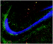 Graphical abstract: Elemental characterisation of the pyramidal neuron layer within the rat and mouse hippocampus