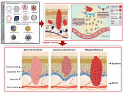 Graphical abstract: Unravelling the potential role of polyethyleneimine (PEI)-based nanosystems in skin cancer therapy