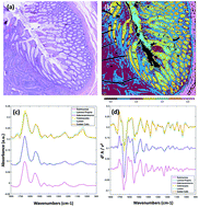 Graphical abstract: High definition infrared chemical imaging of colorectal tissue using a Spero QCL microscope