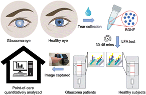 Graphical abstract: Quantitative brain-derived neurotrophic factor lateral flow assay for point-of-care detection of glaucoma