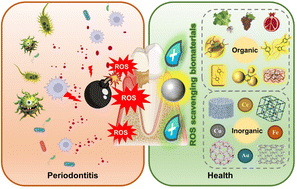 Graphical abstract: ROS-scavenging biomaterials for periodontitis