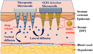 Graphical abstract: Revealing drug release and diffusion behavior in skin interstitial fluid by surface-enhanced Raman scattering microneedles