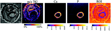 Graphical abstract: Multimodal imaging of undecalcified tissue sections by MALDI MS and μXRF