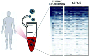 Graphical abstract: Protein corona fingerprinting to differentiate sepsis from non-infectious systemic inflammation