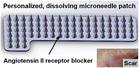 Graphical abstract: Intradermal delivery of an angiotensin II receptor blocker using a personalized microneedle patch for treatment of hypertrophic scars