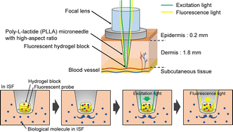 Graphical abstract: Development of an optical microneedle device embedding sub-nanoliter volumes of boronic acid-based fluorescent hydrogel