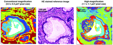 Graphical abstract: High-resolution FTIR imaging of colon tissues for elucidation of individual cellular and histopathological features