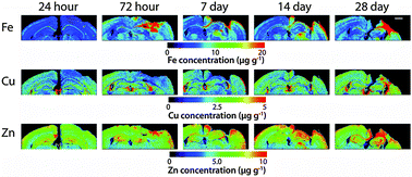 Graphical abstract: A time-course analysis of changes in cerebral metal levels following a controlled cortical impact