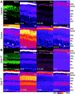 Graphical abstract: X-ray fluorescence microscopic measurement of elemental distribution in the mouse retina with age