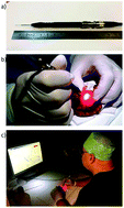 Graphical abstract: Raman spectroscopy for cancer detection and cancer surgery guidance: translation to the clinics