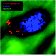 Graphical abstract: Mapping sub-cellular protein aggregates and lipid inclusions using synchrotron ATR-FTIR microspectroscopy