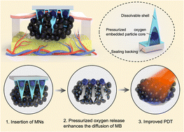 Graphical abstract: Filling core–shell microneedles with pressurized oxygen-embedded particles (POPs) to improve photodynamic therapy