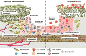 Graphical abstract: Engineering a bacterial polysaccharide-based metal–organic framework-enhanced bioactive 3D hydrogel for accelerated full-thickness wound healing