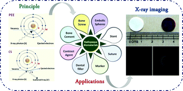 Graphical abstract: Intrinsically radiopaque biomaterial assortments: a short review on the physical principles, X-ray imageability, and state-of-the-art developments