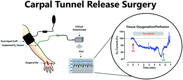 Graphical abstract: Development and validation of a real-time microelectrochemical sensor for clinical monitoring of tissue oxygenation/perfusion