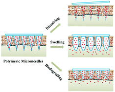 Graphical abstract: Recent advances in the design of polymeric microneedles for transdermal drug delivery and biosensing