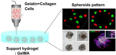 Graphical abstract: Embedded bioprinted multicellular spheroids modeling pancreatic cancer bioarchitecture towards advanced drug therapy