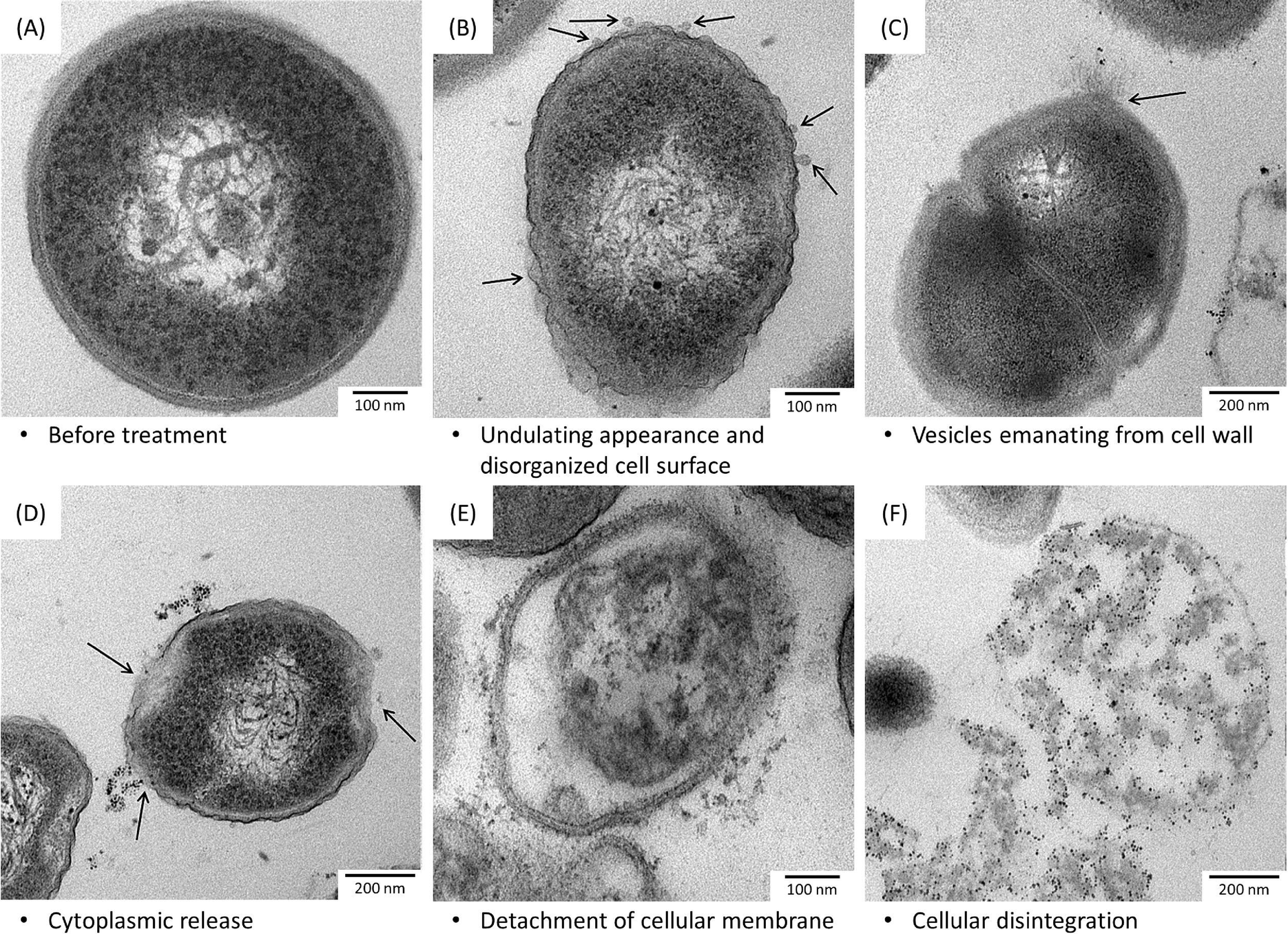 Towards understanding the antibacterial activity of Ag nanoparticles