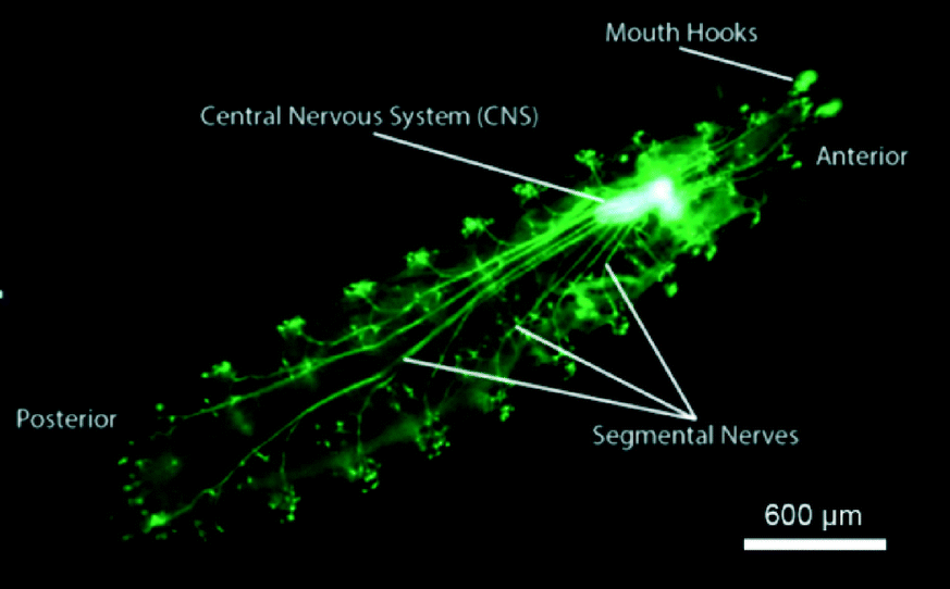 Neurological neus gt 