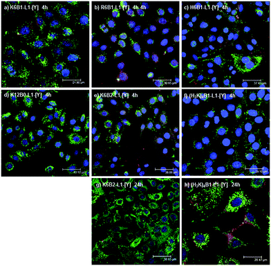 Delivery of siRNA using ternary complexes containing branched cationic ...