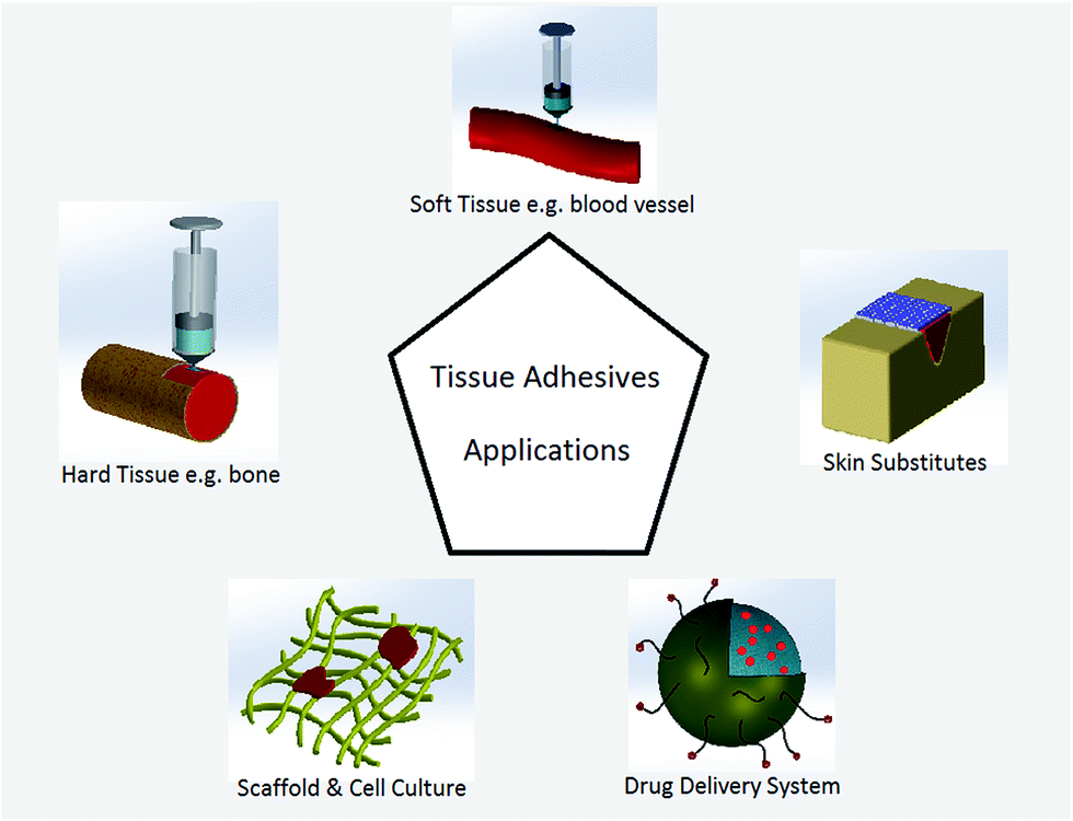 Musselinspired hydrogel tissue adhesives for wound closure RSC