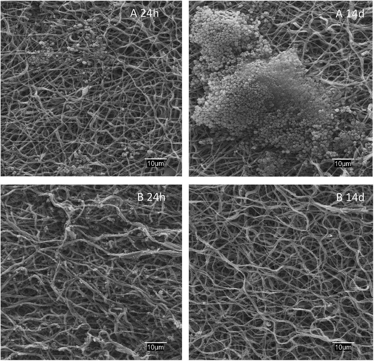 Incorporation Of Antimicrobial Peptides On Electrospun Nanofibres 6 Sem Micrographs Of Paa Pva A And Lysozyme Loaded L 1 B Dressings After 24 H 14 Days In Contact With S Aureus Cultures At 37 C