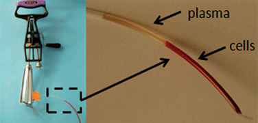 Graphical abstract: Egg beater as centrifuge: isolating human blood plasma from whole blood in resource-poor settings