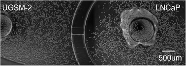 Graphical abstract: Hedgehog signaling in myofibroblasts directly promotes prostate tumor cell growth