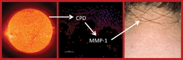 Graphical abstract: Human erythema and matrix metalloproteinase-1 mRNA induction, in vivo, share an action spectrum which suggests common chromophores