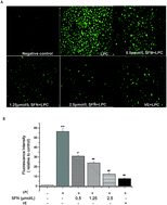 Graphical abstract: Sulforaphane protected the injury of human vascular endothelial cell induced by LPC through up-regulating endogenous antioxidants and phase II enzymes