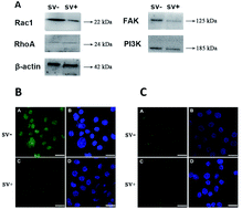 Graphical abstract: A synthetic peptide inhibits human ovarian cancer cell motility