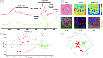Graphical abstract: Retrospective case study on the suitability of mid-infrared microscopic imaging for the diagnosis of mucormycosis in human tissue sections