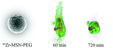 Graphical abstract: Quantitative and correlative biodistribution analysis of 89Zr-labeled mesoporous silica nanoparticles intravenously injected into tumor-bearing mice