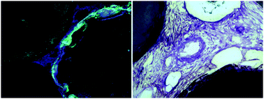 Graphical abstract: Effect of magnesium particle fraction on osteoinduction of hydroxyapatite sphere-based scaffolds