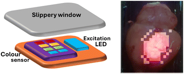 Graphical abstract: Miniature fluorescence sensor for quantitative detection of brain tumour