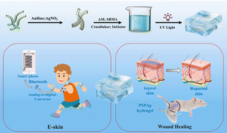 Graphical abstract: Flexible and antibacterial conductive hydrogels based on silk fibroin/polyaniline/AgNPs for motion sensing and wound healing promotion under electrical stimulation