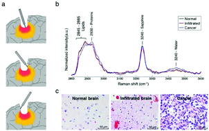 Graphical abstract: Raman spectroscopy and neuroscience: from fundamental understanding to disease diagnostics and imaging