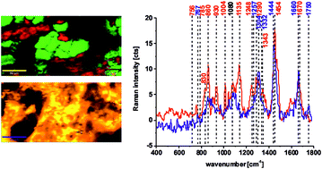 Graphical abstract: Label-free determination of lipid composition and secondary protein structure of human salivary noncancerous and cancerous tissues by Raman microspectroscopy