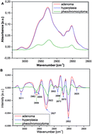 Graphical abstract: Biomolecular characterization of adrenal gland tumors by means of SR-FTIR