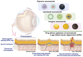 Graphical abstract: Advanced nanomedicines for the treatment of age-related macular degeneration