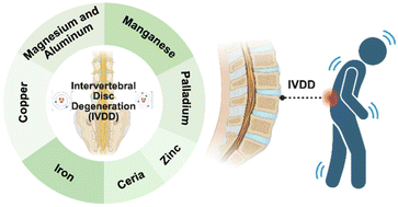 Graphical abstract: The application prospect of metal/metal oxide nanoparticles in the treatment of intervertebral disc degeneration
